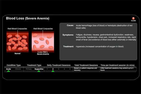 Crush Injury Acute