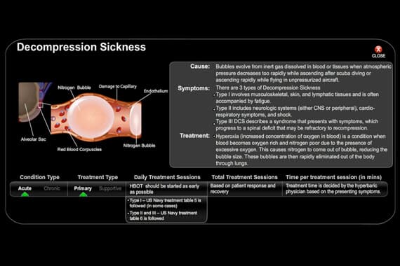 Decompression Sickness