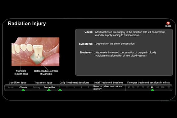 Radiation Injury