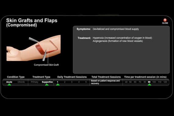 Skin Grafts and Flaps