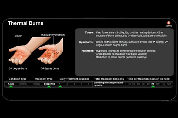 Thermal Burn